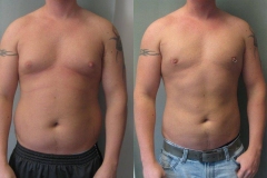 Combined-Procedures-6440