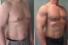 Combined-Procedures-6465-2