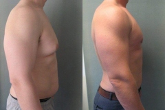 Combined-Procedures-6465-3