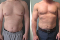 Combined-Procedures-6465