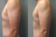 Combined-Procedures-6637-3