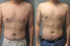 Combined-Procedures-6637