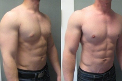 Combined-Procedures-6748-2