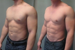 Combined-Procedures-6748-3