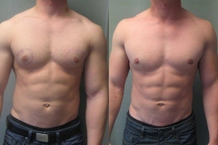 Combined-Procedures-6748