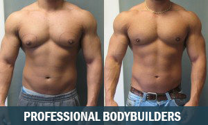 Professional Bodybuilder